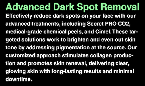 dark spots face treatment before after mississauga oakville
